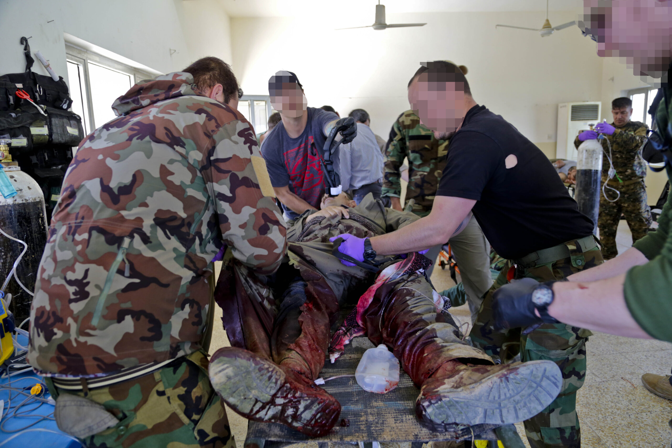 Casualty_2_pixel_fz742l